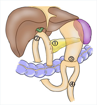 切除後の再建について