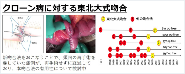 6. 炎症性腸疾患（クローン病、潰瘍性大腸炎）